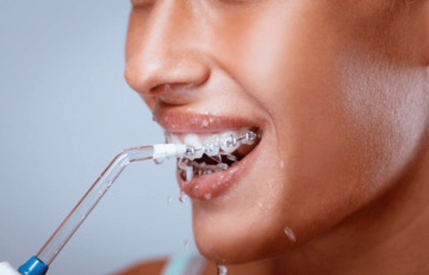 Featured image for “How To Maintain Oral Hygiene While Wearing Braces?”