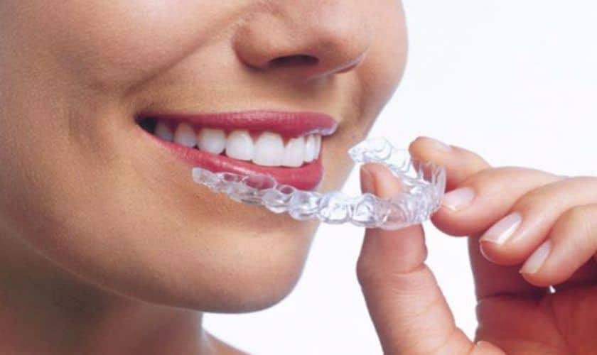 Why Invisalign® is the Best…!?